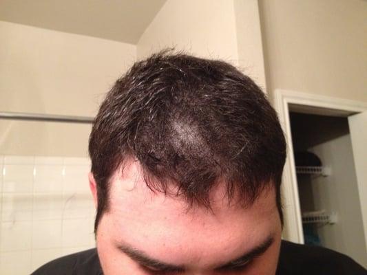 My boyfriends haircut... The worst I've ever seen!!!