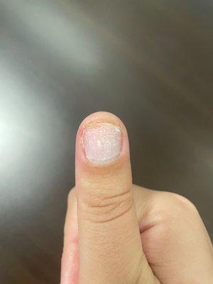 As you can see, the tip of my nail was already changing color.