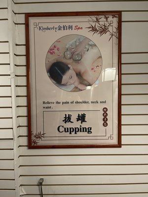 Cupping picture