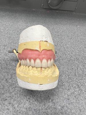 Removable Restorations Dental Lab