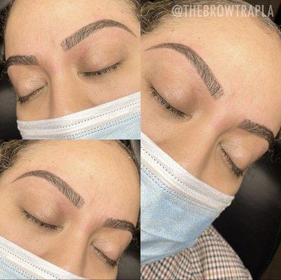 The Brow Trap