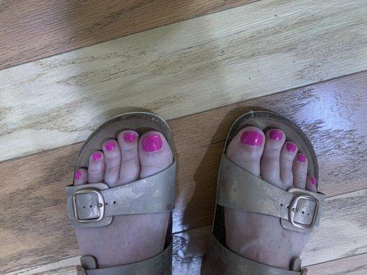 One ugly pedi!