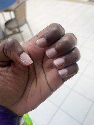 Ugly nails