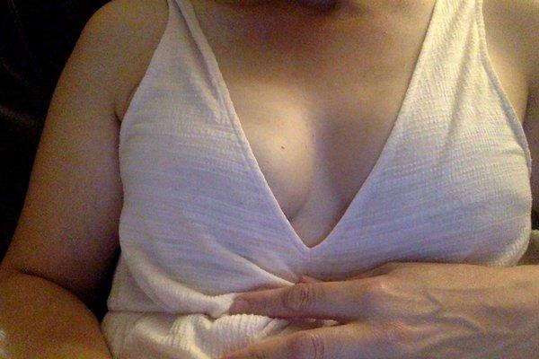 tissue expanders after bilateral mastectomy to prep for full reconstruction. instant cleavage and they appear real under my clothes