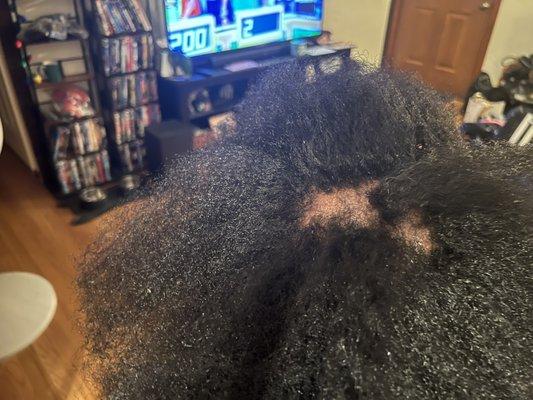 My daughter had very healthy 4C hair and no scalp issues. After going to Nikki, this is the damage.