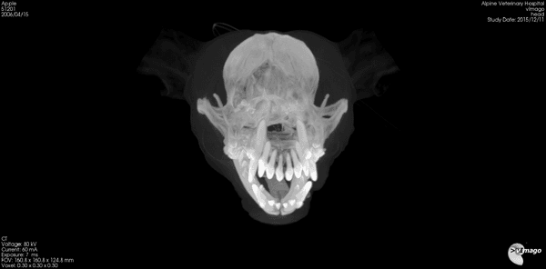 Skull CT 3D Maximum Intensity Projection