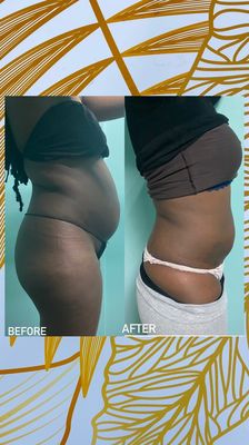 Body cavitation results