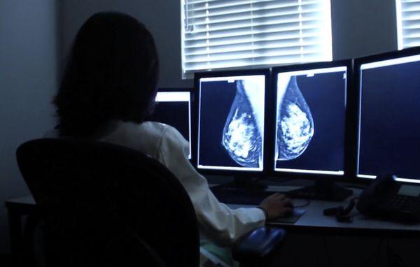 Mammography interpretation