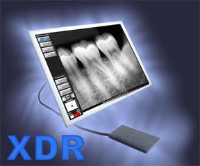 Digital Radiography