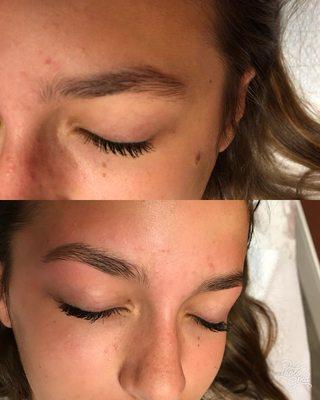 Before and after (eyebrow wax)