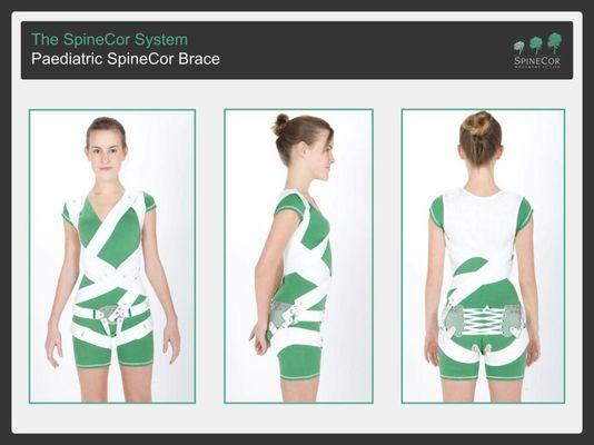 Certified Spinecor Scoliosis Bracing