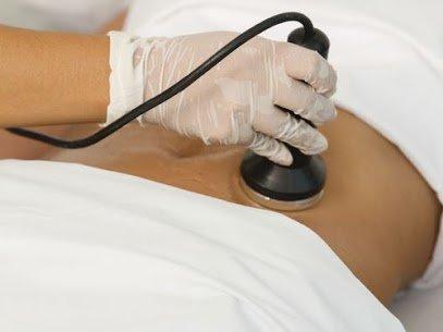 Ultrasound Cavitation is a noninvasive body contouring method to reduce the appearance of fat on the body.