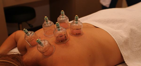 cupping