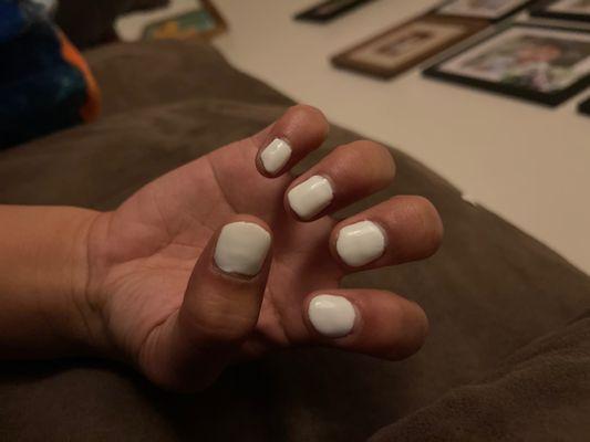 Horrible nails