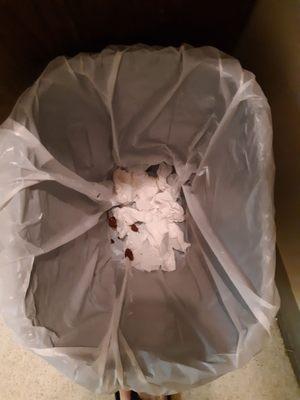 Poop in the trash can