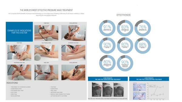 How our shockwave treatment can help you