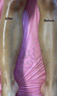 Leg Wax. Before & After