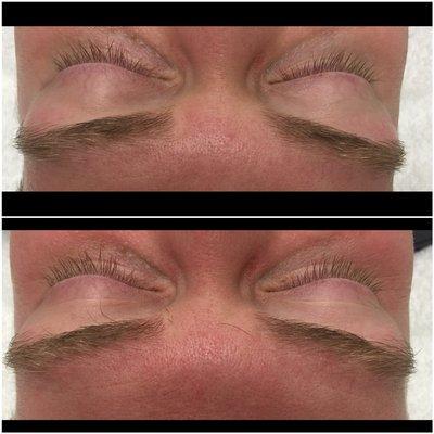 After & before, brow wax. (Male)