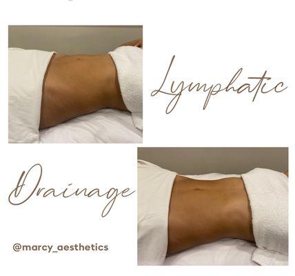 Lymphatic Drainage