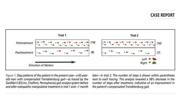 GaitMat recording of patient's improved walking after Osteopathic treatment by Dr Gilliss.