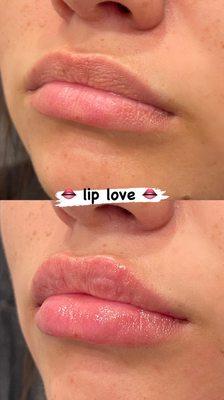 Love these lips