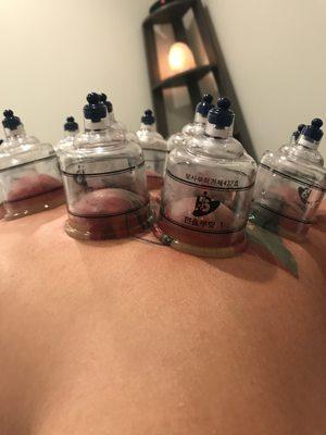 Cupping