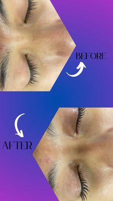 Lush lash lift