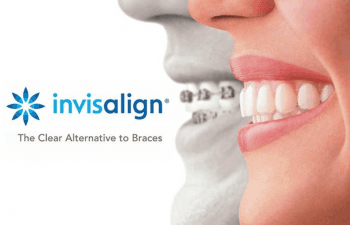 Invisalign is the clear path to straighter teeth and a more confident smile.