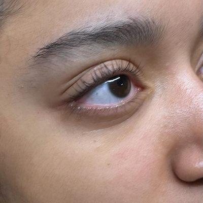 Lash lift