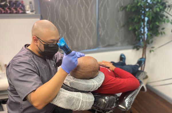 Doing scalp micropigmentation treatment on a failed transplant client in Buffalo, NY.