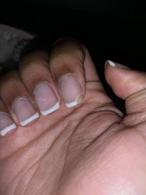 A picture of one of my chipped nails