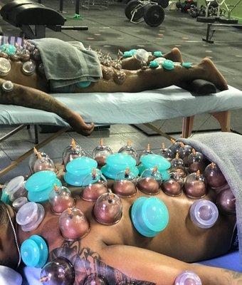 Athletic Cupping Recovery