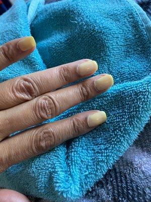 All of my nails turned yellow one week after manicure.