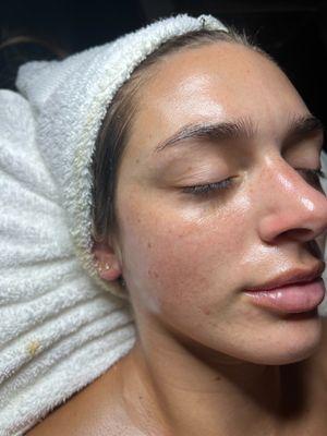 Lavender Moon Custom Facial + Dermaplane.