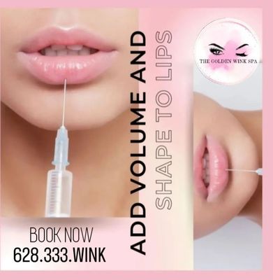 1ml Lip Filler for just $395 (reg. $650)

Don't miss out on this incredible deal! Limited spots are available.