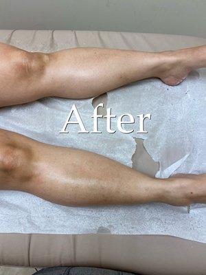 After full leg wax