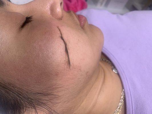 Dermaplaning Facial