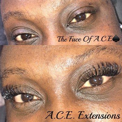 A.C.E. Extensions