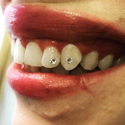 Tooth Gems done by our 20+ year veteran Ms Dee. The appointment book for her services is finally open. Visit our website for more info.