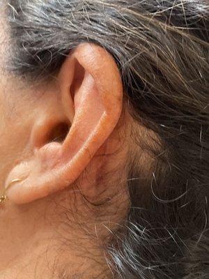 Hair dye in the ear and scalp