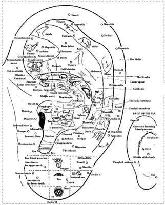 Auricular system