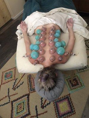 Massage and cupping can help improve flexibility, increase range of motion, decrease pain, and break up scar tissue and adhesions.