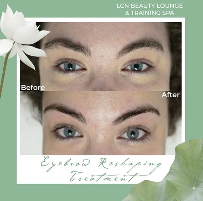 Eyebrow Reshaping Treatment