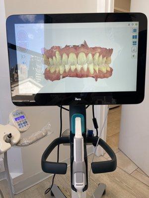 3d teeth scan