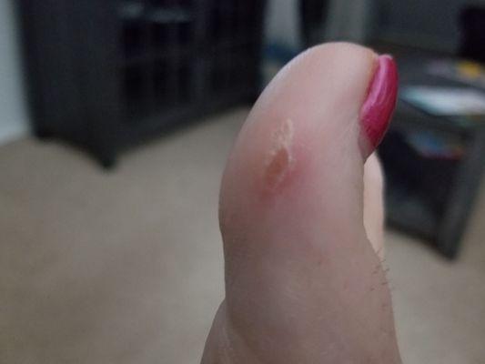 This is my toe a month after it was burned by the gel the technician put on it.  STAY AWAY FROM THIS PLACE!!!