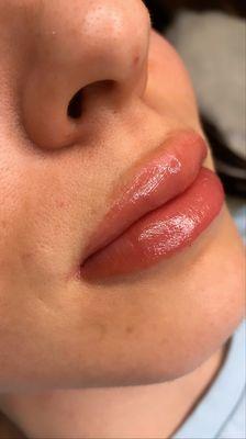 One treatment of Lip Blush