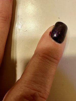 Nail bed bleeding from crappy work