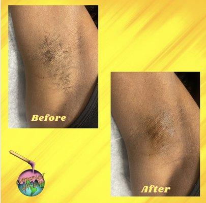 before and after underarm wax