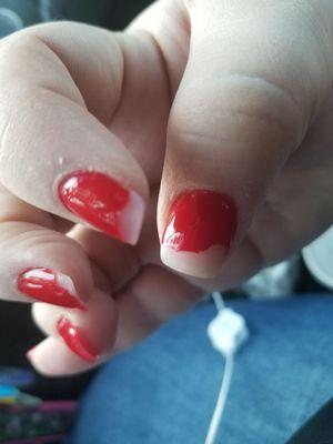 gel refill 1 week later. NOT happy.