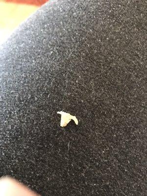 My left over tooth